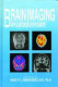 Brain imaging : applications in psychiatry /
