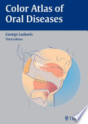 Color atlas of oral diseases /
